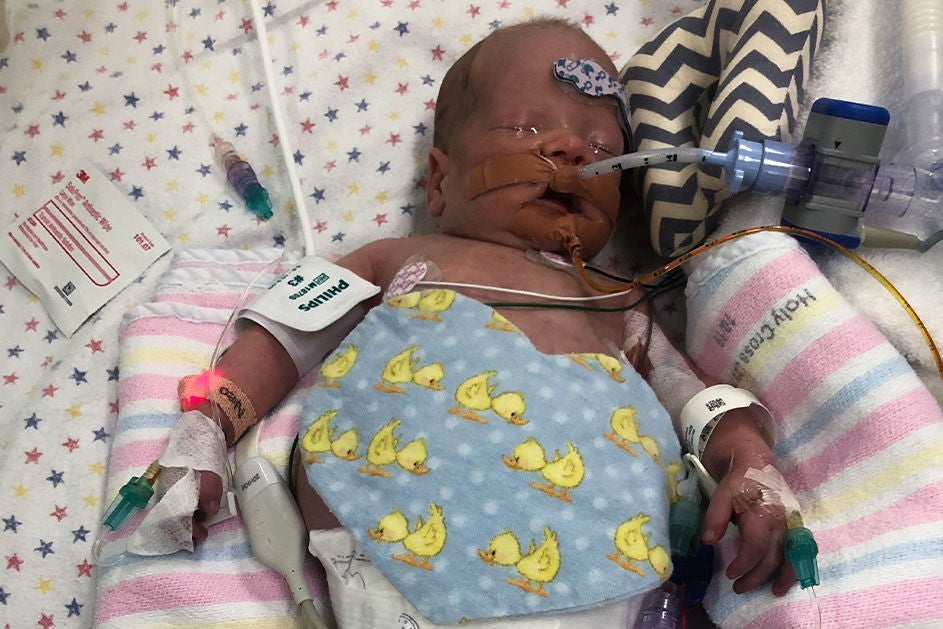Baby Evans in hospital.