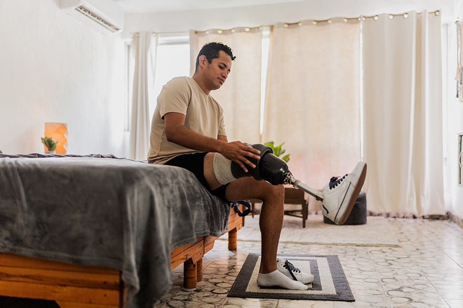 A man sitting on a bed with his leg elevated in a cast.