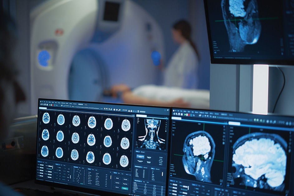 MRI images displayed on a computer screen, focused on the details.
