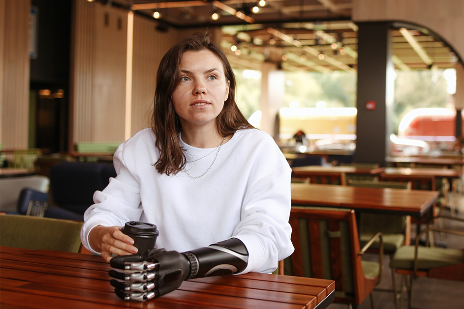 Woman with prosthetic arm drinks coffee in café in Victoria