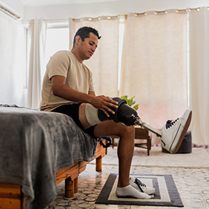 A man sitting on a bed with his leg elevated in a cast.