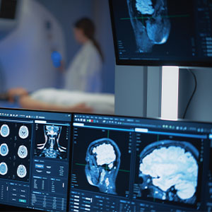 MRI images displayed on a computer screen, focused on the details.