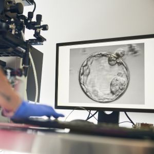 A person examines a computer screen while using a microscope, focused on detailed scientific analysis.