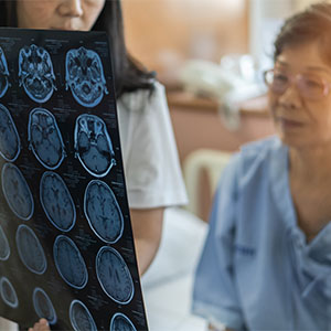 A doctor holding up brain scan images while an older patient looks on during a medical consultation.